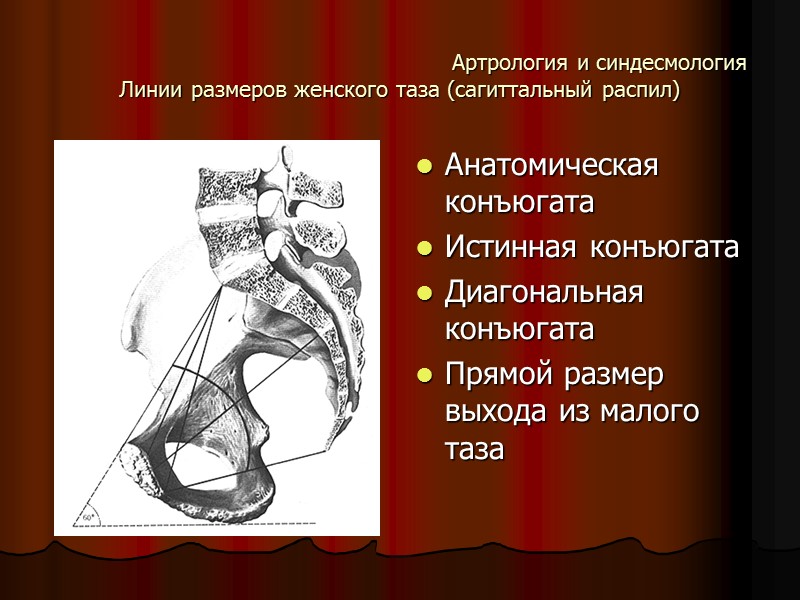 Артрология и синдесмология Линии размеров женского таза (сагиттальный распил) Анатомическая конъюгата Истинная конъюгата Диагональная